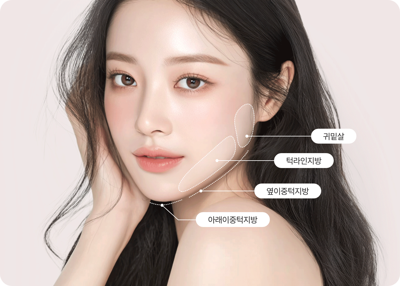 디마레 얼굴지방흡입 3가지 차별화 기준, 관자놀이와 광대 라인을 살리는 정교한 디자인(Standard 01), 얼굴 전체의 밸런스 조화(Standard 02), 피부 처짐 없이 밀착되는 리프팅 고정 효과(Standard 03) 설명