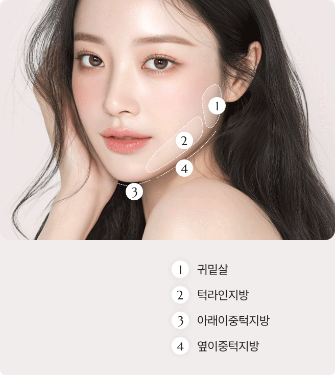 디마레 얼굴지방흡입 3가지 차별화 기준, 관자놀이와 광대 라인을 살리는 정교한 디자인(Standard 01), 얼굴 전체의 밸런스 조화(Standard 02), 피부 처짐 없이 밀착되는 리프팅 고정 효과(Standard 03) 설명