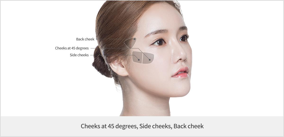Facial Liposuction