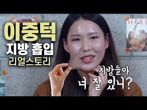 헤어진 얼굴지방아...자니?