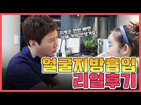 이중턱, 턱살 얼굴 지방흡입 V라인 턱선 만들기 리얼 후기! 얼굴 비대칭 교정까지 가능?! 시술 후 관리까지!