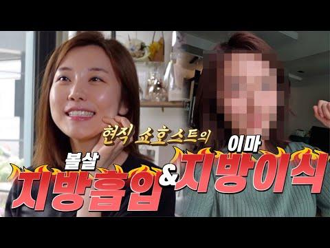 미모의 쇼호스트 지방 흡입, 지방 이식 리얼 후기 