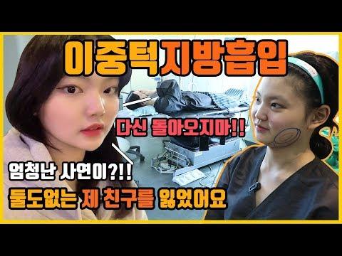 이중턱지방흡입 & 브이라인 리얼브이로그 내 턱살에 무슨 일이... 자연스러우면서도 완벽한 결과를 원한다면?!! 꼭 봐야 하는 리얼 후기 영상 [쀼]