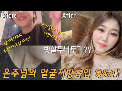 마레TV 3편! 은주님의 솔직담백한 Q&A !! 빗살무늬토기? 엄마한테도 추천?? 볼살지방흡입/이중턱지방흡입 궁금한거 다 부시기!!