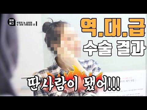 이 정도면 지방 흡입 할 만하다