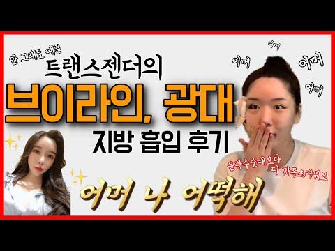 윤곽수술보다 만족스러운 얼굴 지방흡입