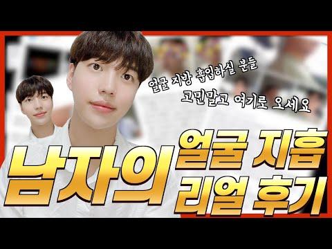 남자 수술 100%리얼 후기