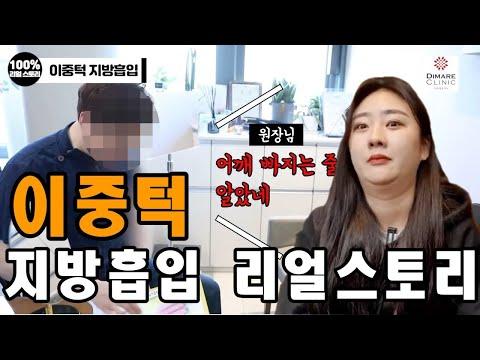 어깨 빠질뻔한 이중턱 지방 양...과연 얼마나 달라졌을까요?