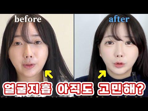 얼굴살 고민에는 사실 이게 제일 효과가 좋더라구요