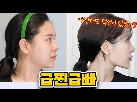 잃어버린 턱선 찾기