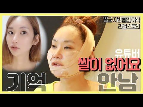 쌀이 없어요님도 받은 디마레의 얼굴 지방흡입