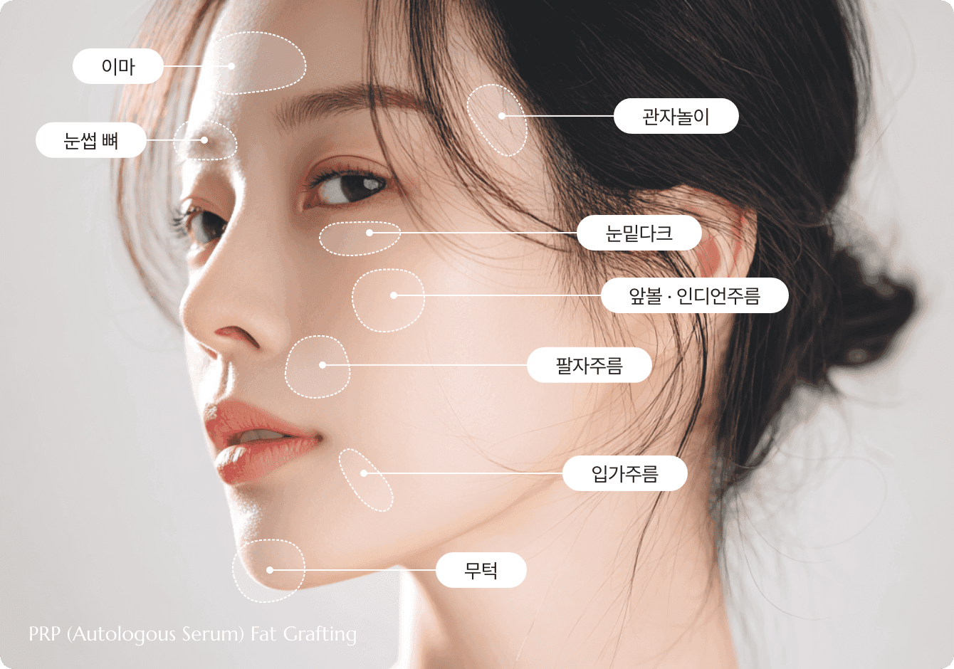 디마레 PRP 얼굴지방이식, 자가혈에서 추출한 고농축 혈소판 성장인자를 지방과 함께 이식하여 생착률을 극대화하고 피부 재생을 돕는 시너지 시술