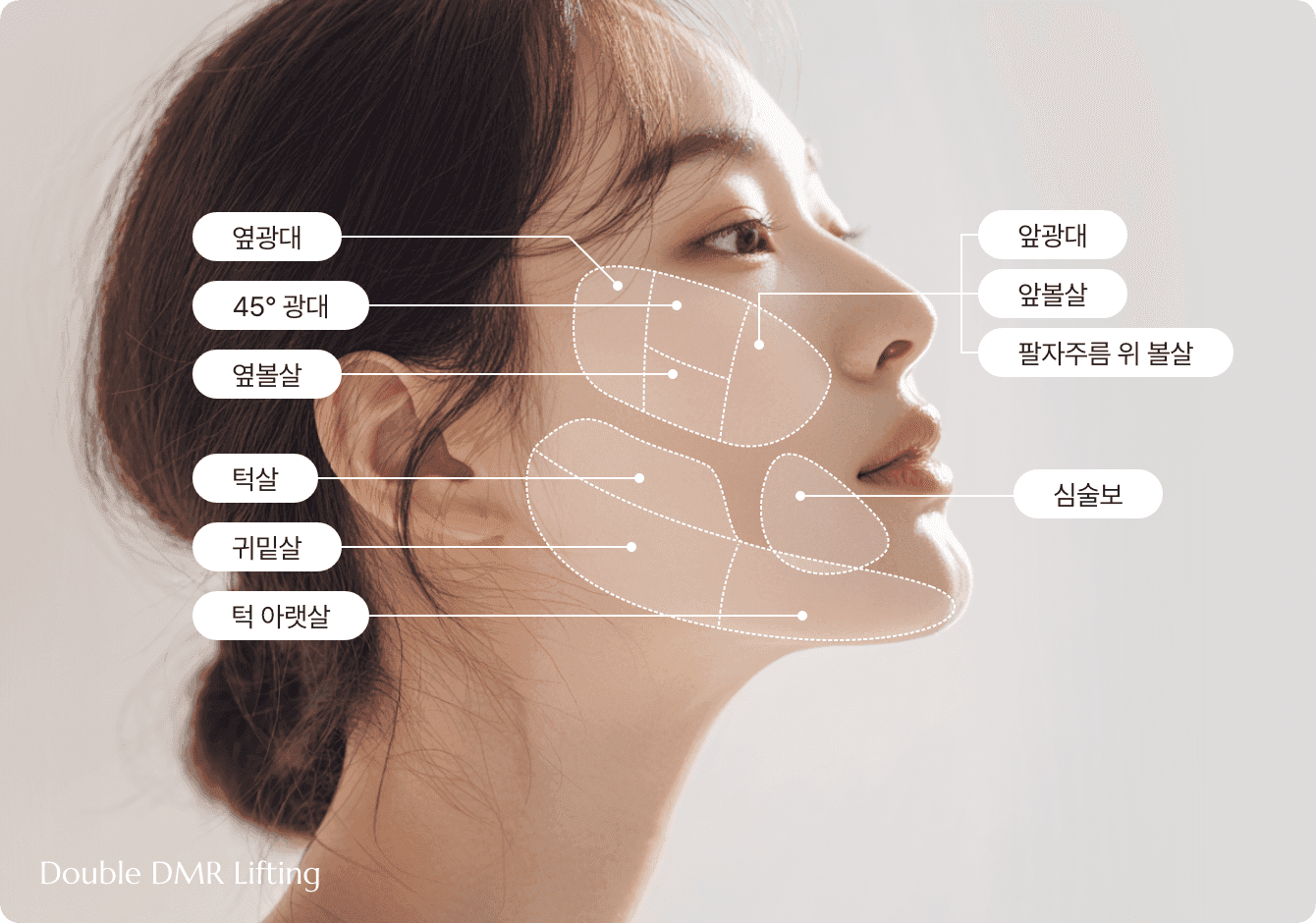 디마레 더블 DMR 리프팅 시술 부위, 녹는 실(PDO)을 이용하여 심술보·팔자주름·앞광대·턱선·이중턱 등 처진 조직을 정교하게 당겨 올리고 자연스러운 표정을 만드는 리프팅 디자인 상세