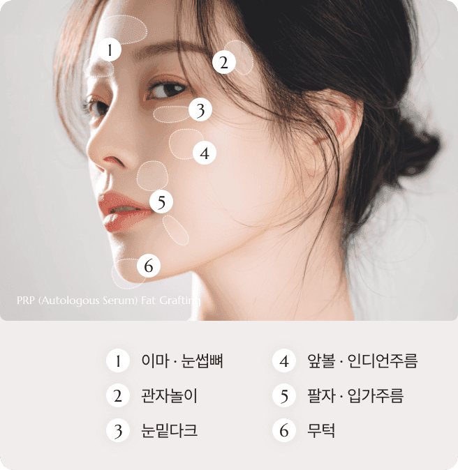 디마레 PRP 얼굴지방이식, 자가혈에서 추출한 고농축 혈소판 성장인자를 지방과 함께 이식하여 생착률을 극대화하고 피부 재생을 돕는 시너지 시술