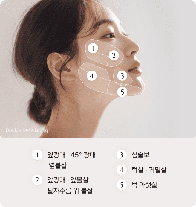 디마레 더블 DMR 리프팅 시술 부위, 녹는 실(PDO)을 이용하여 심술보·팔자주름·앞광대·턱선·이중턱 등 처진 조직을 정교하게 당겨 올리고 자연스러운 표정을 만드는 리프팅 디자인 상세