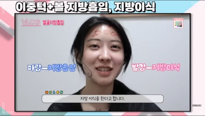 디마레 클리닉 지방흡입 대상